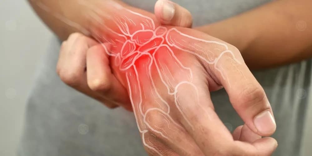 أنواع التهاب المفاصل