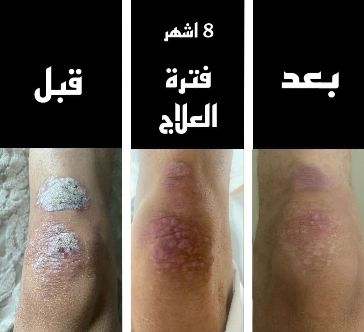 صحة الجلد والبشرة