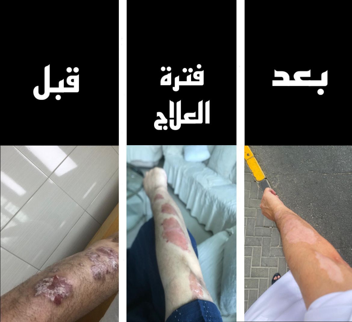 صحة الجلد و البشرة