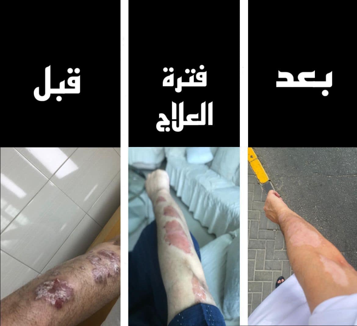 صحة الجلد و البشرة