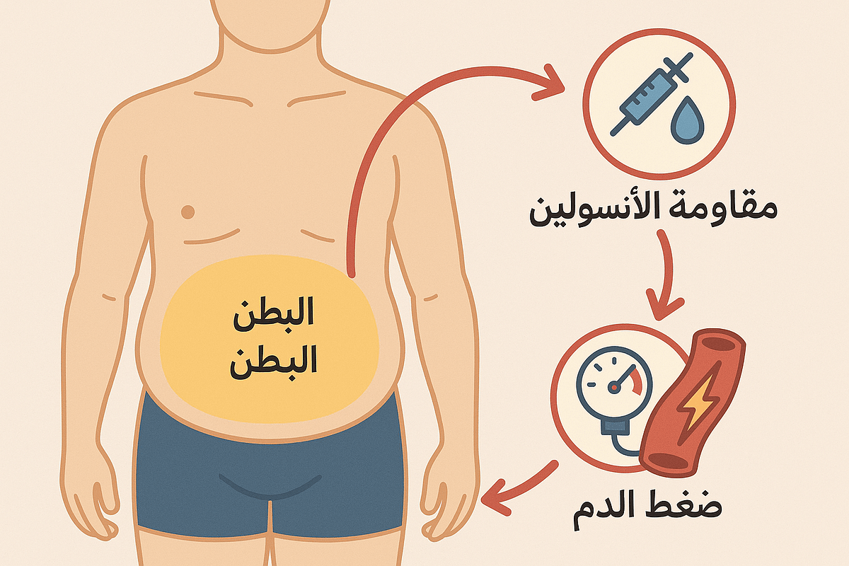 متلازمة الأيض