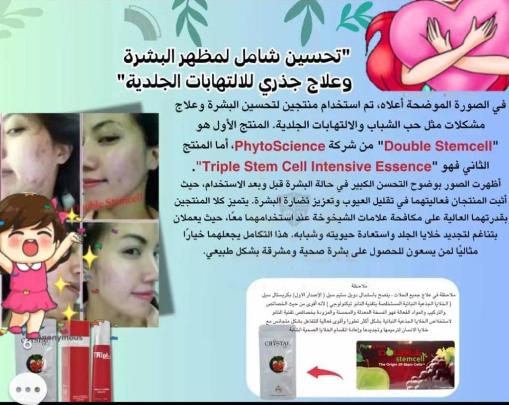 الخلايا الجذعية النباتية